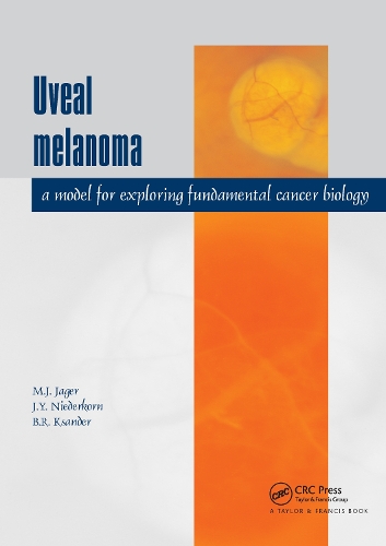 Паперова книга «Uveal Melanoma: A Model for Exploring Fundamental Cancer Biology» - фото №1
