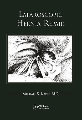 Паперова книга «Laparoscopic Hernia Repair», автор Майкл С. Кавік - фото №1