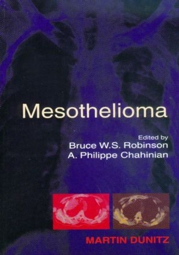 Бумажная книга «Mesothelioma» - фото №1