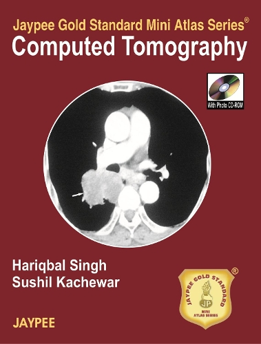 Бумажная книга «Jaypee Gold Standard Mini Atlas Series of Computed Tomography», автор Харикбал Сингх - фото №1