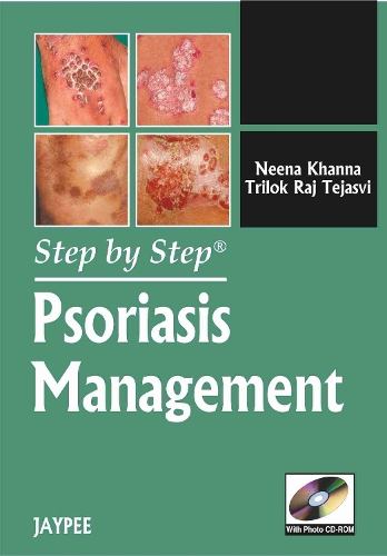 Паперова книга «Step by Step: Psoriasis Management», автор Німа Кханна - фото №1
