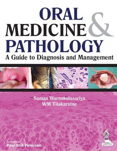 Бумажная книга «Oral Medicine & Pathology:  A Guide to Diagnosis and Management», авторов Саман Варнакуласурия, В. М. Тилакаратна - фото №1