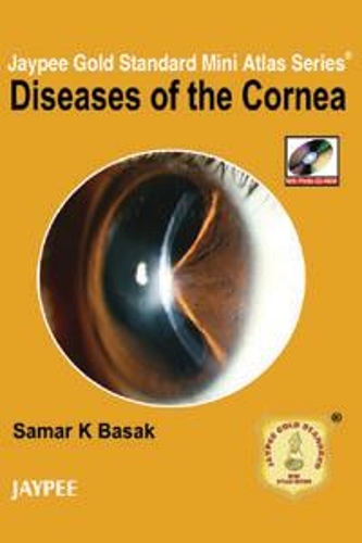 Бумажная книга «Jaypee Gold Standard Mini Atlas Series: Diseases of the Cornea», автор Самар К Басак - фото №1