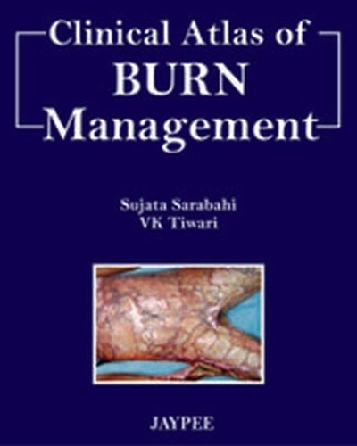 Бумажная книга «Clinical Atlas of Burn Managment», авторов Суджата Сарабахи, В.К. Тивари - фото №1