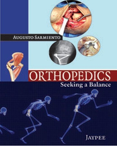 Бумажная книга «Orthopedics: Seeking a Balance», автор Аугусто Сармьенто - фото №1