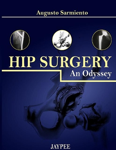 Паперова книга «Hip Surgery: An Odyssey», автор Аугусто Сармьєнто - фото №1