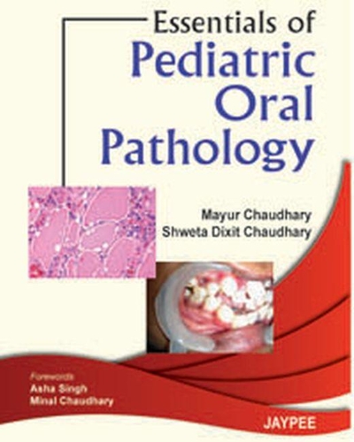 Паперова книга «Essentials of Pediatric Oral Pathology», авторів Маюр Чаудхарі, Швета Діксіт Чодхарі - фото №1
