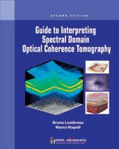 [object Object] «Guide to Interpreting Spectral Domain Optical Coherence Tomography», авторів Бруно Лумброзо, Марко Рісполі - фото №1