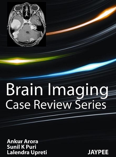Бумажная книга «Brain Imaging: Case Review Series», авторов Анкур Арора, Лалендра Упрети, Сунил Кумар Пури - фото №1