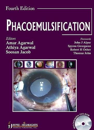 Паперова книга «Phacoemulsification, Fourth Edition», авторів Амар Агарвал, Атхія Агарвал, Сусан Джейкоб - фото №1