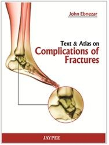 Паперова книга «Text and Atlas of Complications of Fractures», автор Джон Ебнезар - фото №1
