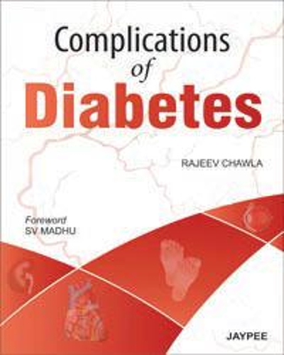 Бумажная книга «Complications of Diabetes», автор Раджив Чавла - фото №1