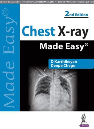 Паперова книга «Chest X-ray Made Easy», авторів Д. Картікеян, Діпа Чегу - фото №1