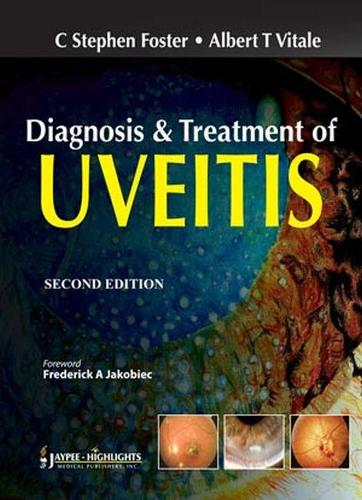 Бумажная книга «Diagnosis & Treatment of Uveitis», авторов Альберт Т. Витале, К Стивен Фостер - фото №1