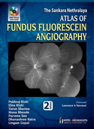 Бумажная книга «Atlas of Fundus Fluorescein Angiography», авторов Дханашри Ратра, Экта Риши, Лингам Гопал, Муна Бхенде, Парвин Сен, Пухрадж Риши, Тарун Шарма - фото №1
