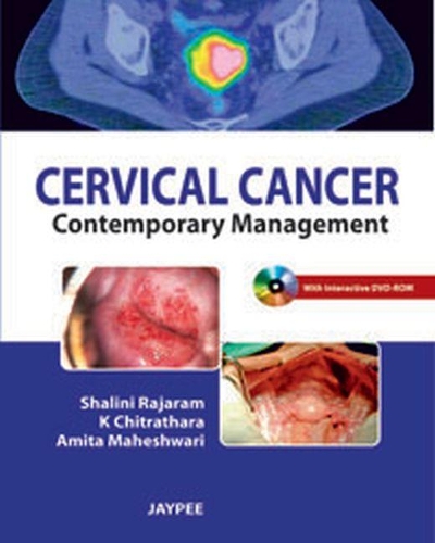 Бумажная книга «Cervical Cancer: Contemporary Management», авторов Амита Махешвари, K Читратхара, Шалини Раджарам - фото №1
