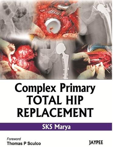 Паперова книга «Complex Primary Total Hip Replacement», автор СКС Мар'я - фото №1