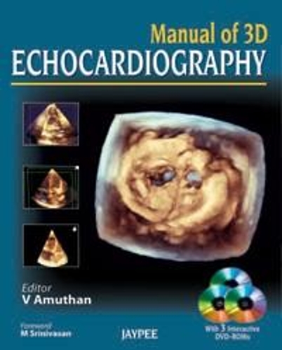 Паперова книга «Manual of 3D Echocardiography», автор В. Амутан - фото №1