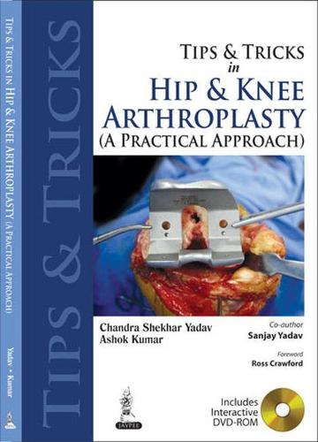 Бумажная книга «Tips and Tricks in Hip and Knee Arthroplasty: (A Practical Approach)», авторов Ашок Кумар, Чандра Шекхар Ядав - фото №1