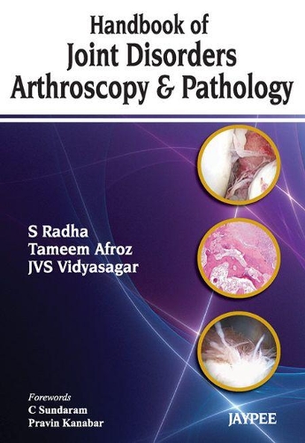 Бумажная книга «Handbook of Joint Disorders Arthroscopy & Pathology», авторов Дж. В. С. Видьясагар, С. Радха, Тамим Афроз - фото №1