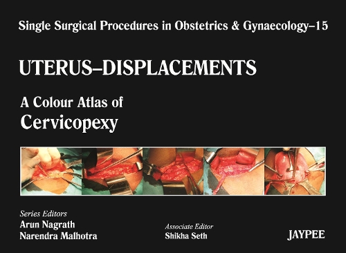 Бумажная книга «Single Surgical Procedures in Obstetrics and Gynaecology - Volume 15 - UTERUS - DISPLACEMENTS: A Colour Atlas of Cervicopexy (Purandare’s)», авторов Арун Награтх, Нарендра Мальхотра, Шикха Сет - фото №1