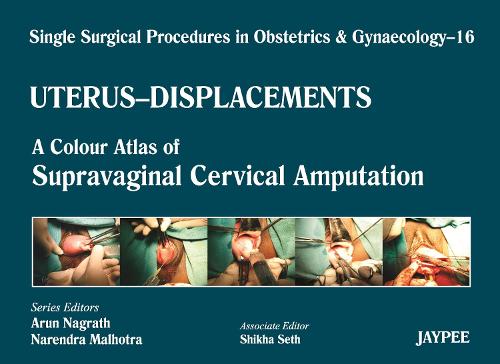 Paper book «Single Surgical Procedures in Obstetrics and Gynaecology - Volume 16 - UTERUS - DISPLACEMENTS: A Colour Atlas of Supravaginal Cervical Amputation (Nadkarni’s)», authors Arun Nagrath, Narendra Malhotra, Shikha Seth - фото №1