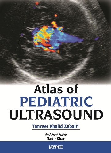 Паперова книга «Atlas of Pediatric Ultrasound», авторів Надір Хан, Танвір Халід Зубайрі - фото №1