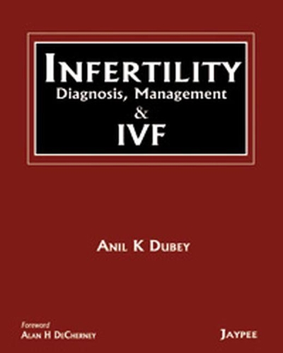 Паперова книга «INFERTILITY Diagnosis, Management and IVF», автор Аніл Дубей - фото №1