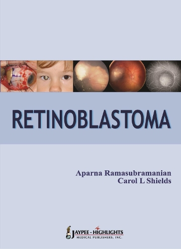 Бумажная книга «Retinoblastoma», авторов Апарна Рамасубраманиан, Кэрол Л. Шилдс - фото №1