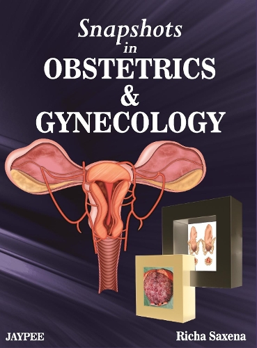 Паперова книга «Snapshots in Obstetrics and Gynaecology», автор Річа Саксена - фото №1