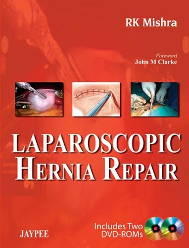 Паперова книга «Laparoscopic Hernia Repair», автор Р. К. Мішра - фото №1