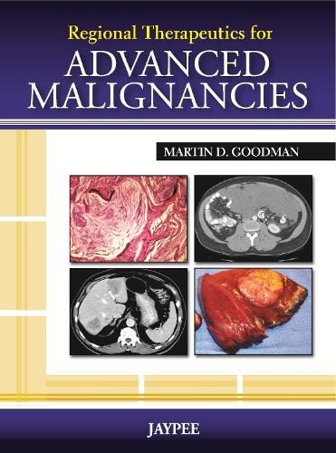 Бумажная книга «Regional Therapeutics for Advanced Malignancies», автор Мартин Гудман - фото №1