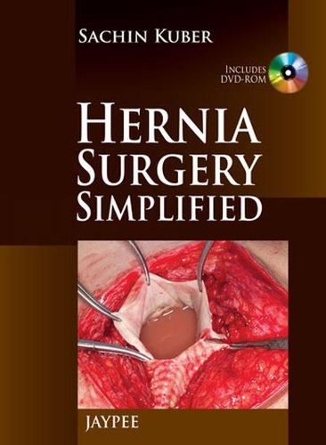 Бумажная книга «Hernia Surgery Simplified», автор Сачин Кубер - фото №1
