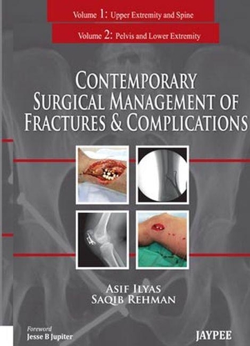 Бумажная книга «Contemporary Surgical Management of Fractures and Complications», авторов Асиф Ильяс, Сакиб Рехман - фото №1