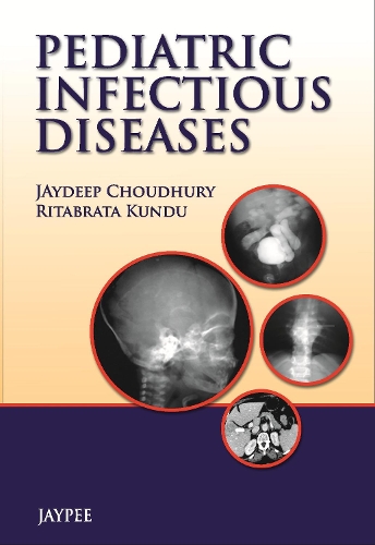 Паперова книга «Pediatric Infectious Diseases», авторів Джайдіп Чоудхурі, Рітабрата Кунду - фото №1