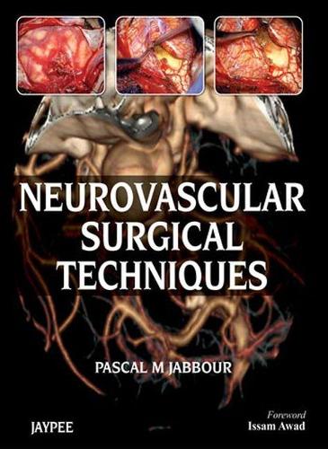 Паперова книга «Neurovascular Surgical Techniques», автор Паскаль М. Жаббур - фото №1