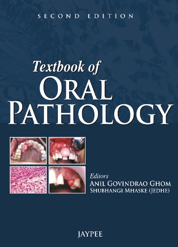 Бумажная книга «Textbook of Oral Pathology», авторов Анил Говиндрао Гом, Шубханги Мхаске - фото №1