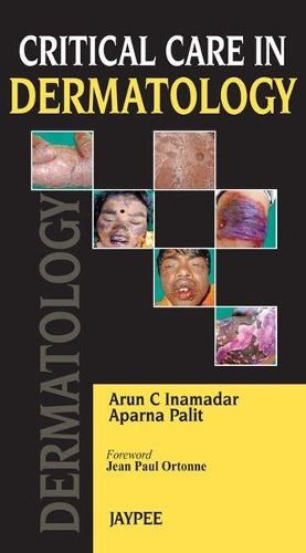 Паперова книга «Critical Care in Dermatology», авторів Апарна Паліт, Арун К. Інамадар - фото №1