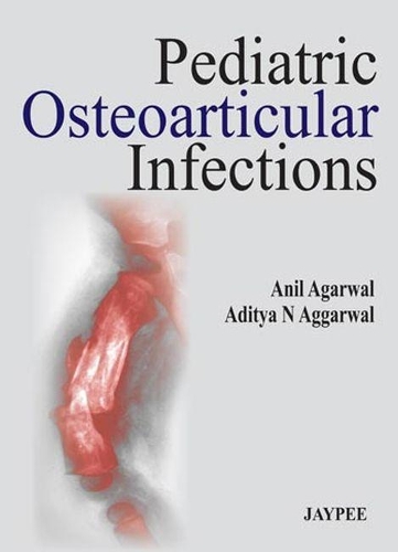 Бумажная книга «Pediatric Osteoarticular Infections», авторов Адитья Н Аггарвал, Анил Агарвал - фото №1