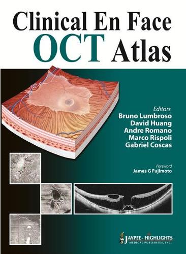 Паперова книга «Clinical En Face OCT Atlas», авторів Андре Романо, Бруно Лумброзо, Девід Хуанг, Габріель Коскас, Марко Рісполі - фото №1