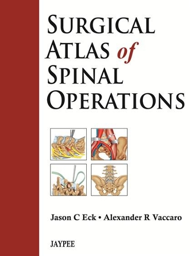 Бумажная книга «Surgical Atlas of Spinal Operations», авторов Александр Ваккаро, Джейсон Эк - фото №1