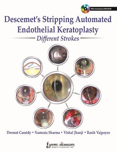 Бумажная книга «Descemet's Stripping Automated Endothelial Keratoplasty: Different Strokes», авторов Дермот Кэссиди, Намрата Шарма, Расик Б Ваджпаи, Вишал Джанджи - фото №1
