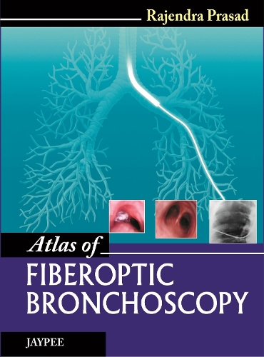Бумажная книга «Atlas of Fiberoptic Bronchoscopy», автор Раджендра Прасад - фото №1