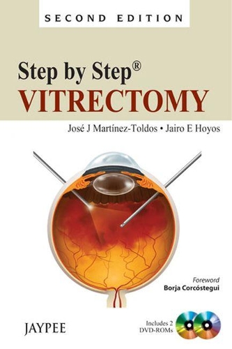 Паперова книга «Step by Step: Vitrectomy», авторів Хайро Е Хойос, Хосе Ж. Мартінез-Толдос - фото №1