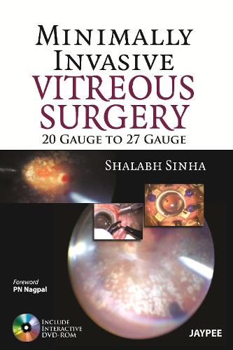 Паперова книга «Minimally Invasive Vitreous Surgery: 20 Gauge to 27 Gauge», автор Шалабх Сінха - фото №1