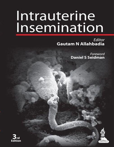 Бумажная книга «Intrauterine Insemination», авторов Гаутам Н Аллахбадия, Рубина Мерчант - фото №1