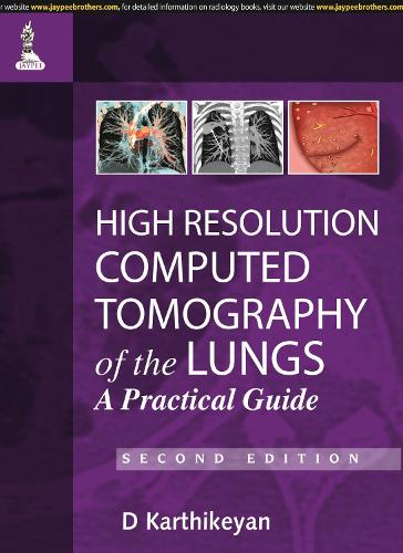 Паперова книга «High Resolution Computed Tomography of the Lungs: A Practical Guide», автор Д. Картікеян - фото №1
