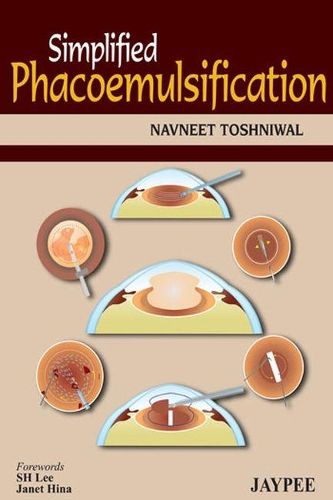 Бумажная книга «Simplified Phacoemulsification», автор Навнит Тошнивал - фото №1