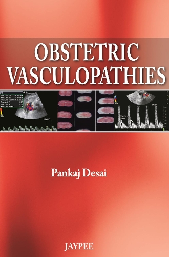 Паперова книга «Obstetric Vasculopathies», автор Панкадж Десаї - фото №1