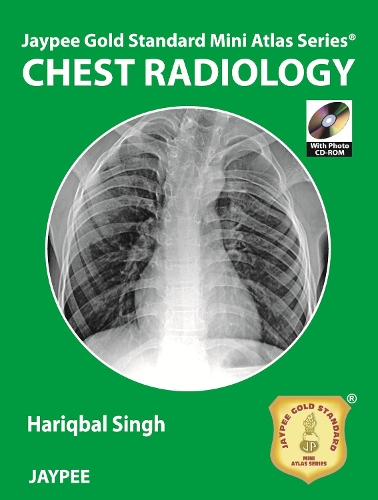 Бумажная книга «Jaypee Gold Standard Mini Atlas Series: Chest Radiology», автор Харикбал Сингх - фото №1